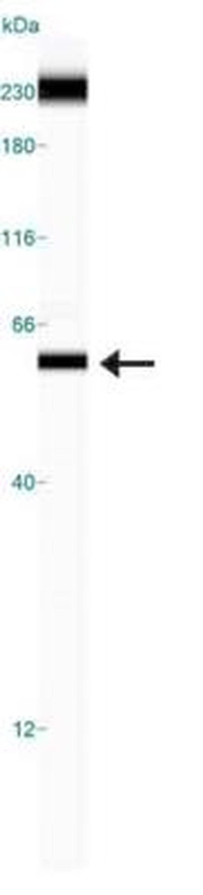 TRF1 Antibody in Western Blot (WB)