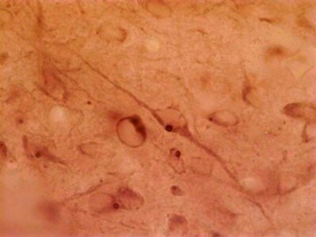 HAP1 Antibody in Immunohistochemistry (Paraffin) (IHC (P))