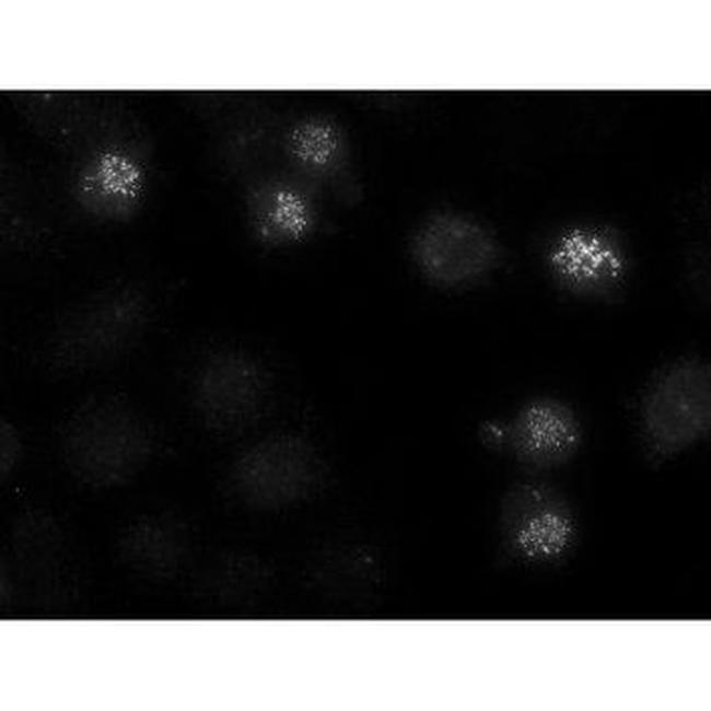 CENPE Antibody in Immunocytochemistry (ICC/IF)