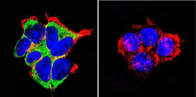 NR3C2 Antibody in Immunocytochemistry (ICC/IF)