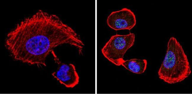 VDR Antibody in Immunocytochemistry (ICC/IF)