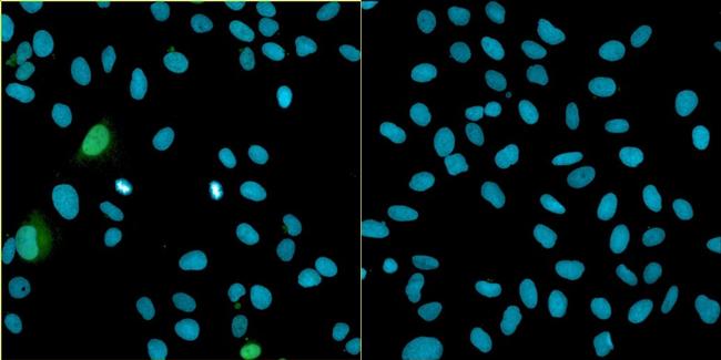 Bovine Papilloma Virus Type 1 E2 Antibody in Immunocytochemistry (ICC/IF)