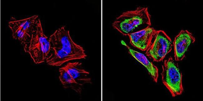 GRK1 Antibody in Immunocytochemistry (ICC/IF)