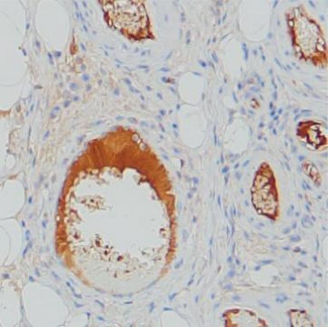 C1 inhibitor Antibody in Immunohistochemistry (Paraffin) (IHC (P))