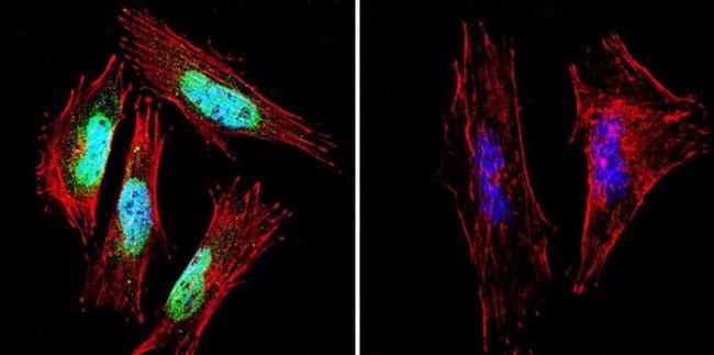 Presenilin 1 Antibody in Immunocytochemistry (ICC/IF)