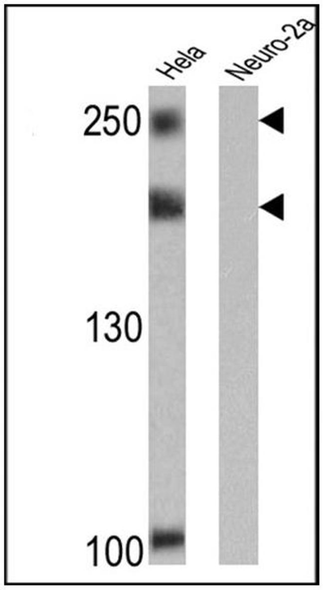 NCoR2 Antibody in Western Blot (WB)