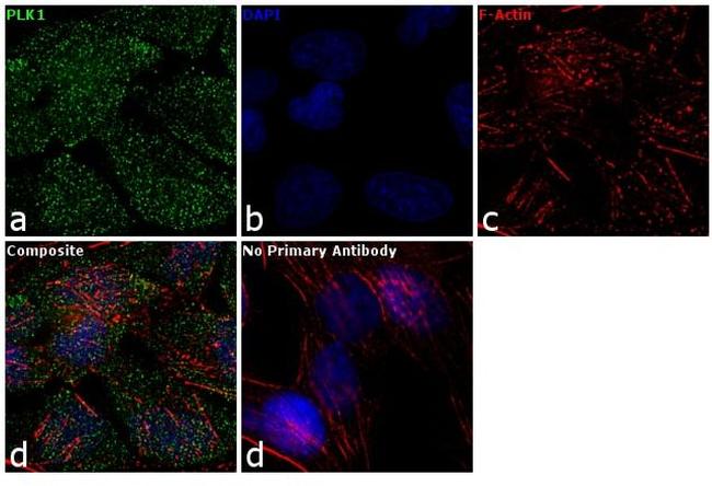 PLK1 Antibody in Immunocytochemistry (ICC/IF)