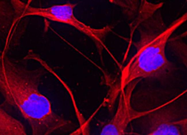 A2B5 Antibody in Immunocytochemistry (ICC/IF)