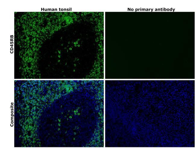 CD45RB Antibody in Immunohistochemistry (Paraffin) (IHC (P))