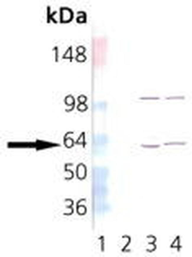 TCP1 Antibody in Western Blot (WB)