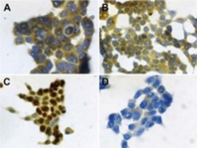 S100A7 Antibody in Immunocytochemistry (ICC/IF)