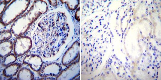 Calcium Sensing Receptor Antibody in Immunohistochemistry (Paraffin) (IHC (P))