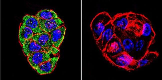 CFTR Antibody in Immunocytochemistry (ICC/IF)