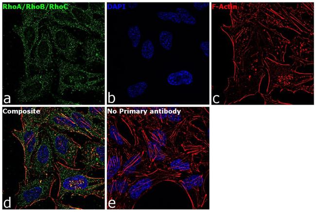 RhoA/RhoB/RhoC Antibody in Immunocytochemistry (ICC/IF)