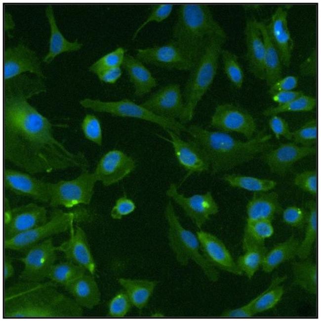 Pan Ras Antibody in Immunocytochemistry (ICC/IF)