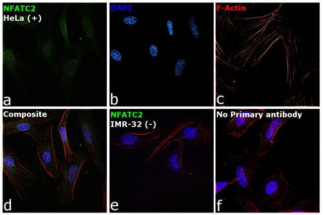 NFATC2 Antibody in Immunocytochemistry (ICC/IF)