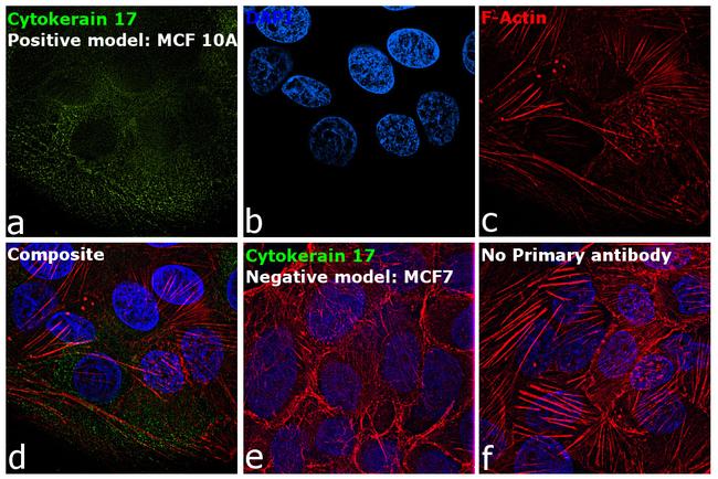 Cytokeratin 17 Antibody in Immunocytochemistry (ICC/IF)