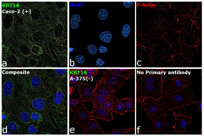 Cytokeratin 18 Antibody in Immunocytochemistry (ICC/IF)