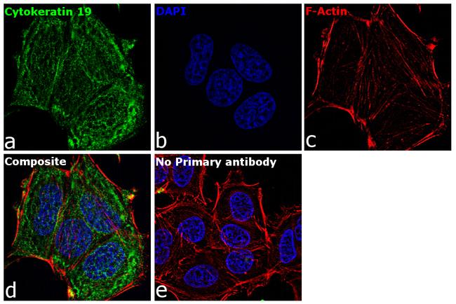 Cytokeratin 19 Antibody in Immunocytochemistry (ICC/IF)