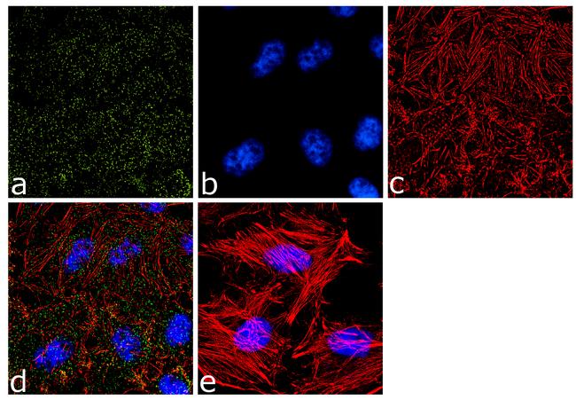 alpha Adaptin Antibody in Immunocytochemistry (ICC/IF)