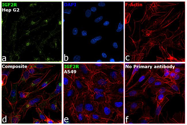 IGF2R Antibody in Immunocytochemistry (ICC/IF)