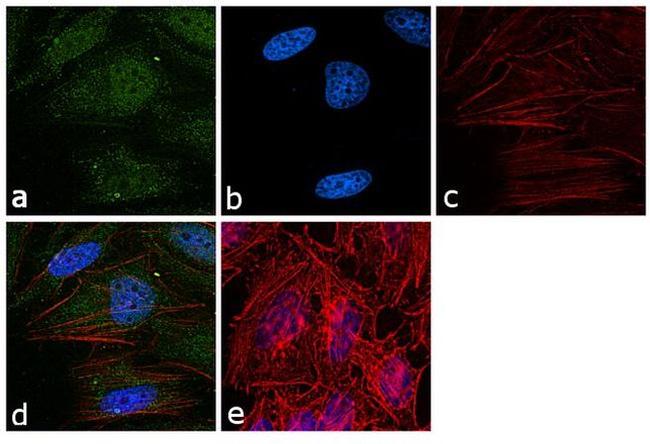 hnRNP K Antibody in Immunocytochemistry (ICC/IF)