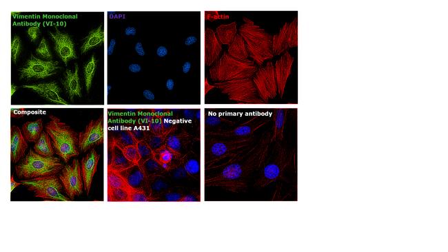 Vimentin Antibody in Immunocytochemistry (ICC/IF)