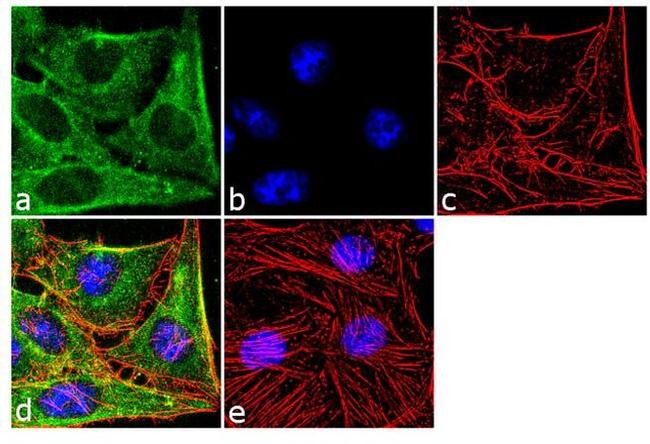 SOD1 Antibody in Immunocytochemistry (ICC/IF)