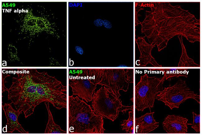 SOD2 Antibody in Immunocytochemistry (ICC/IF)