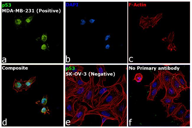 p53 Antibody in Immunocytochemistry (ICC/IF)