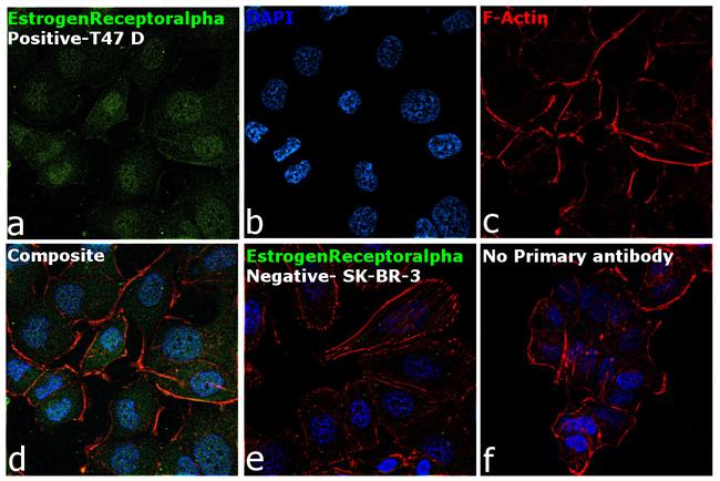 Estrogen Receptor alpha Antibody in Immunocytochemistry (ICC/IF)