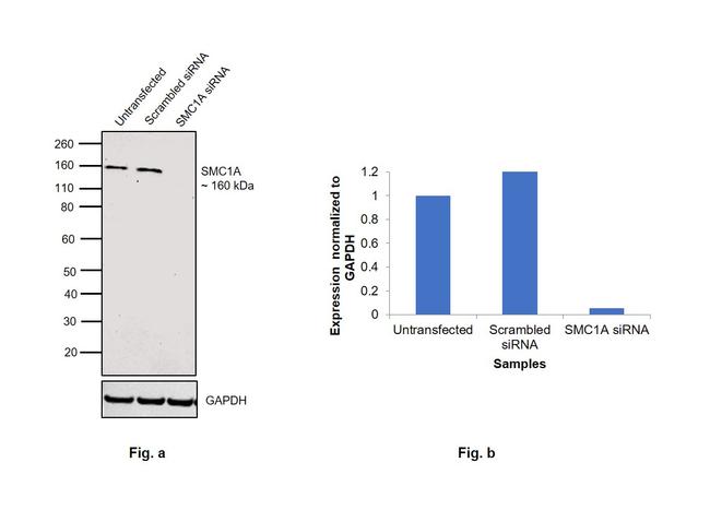 SMC1 Antibody in Western Blot (WB)