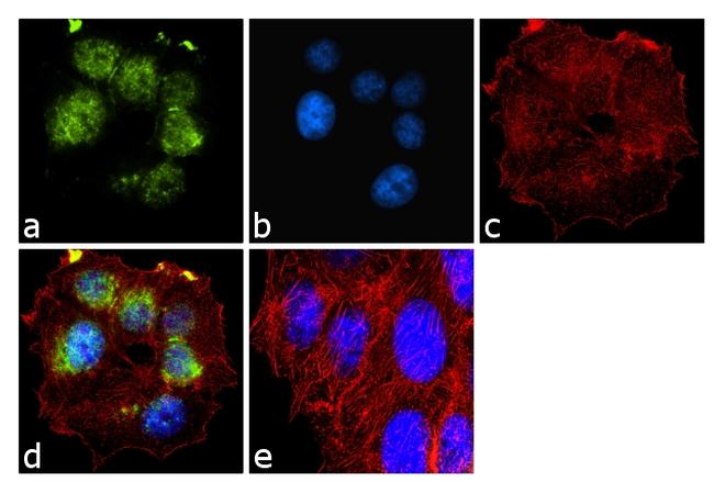 BRCA1 Antibody in Immunocytochemistry (ICC/IF)