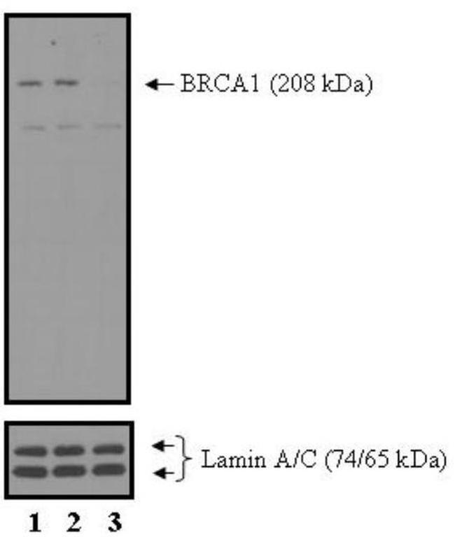 BRCA1 Antibody in Western Blot (WB)