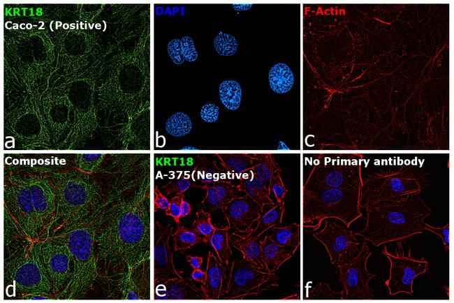 Cytokeratin 18 Antibody in Immunocytochemistry (ICC/IF)