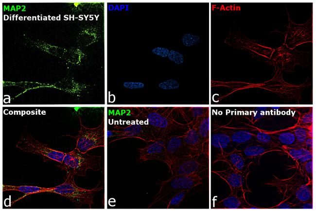 MAP2 Antibody in Immunocytochemistry (ICC/IF)