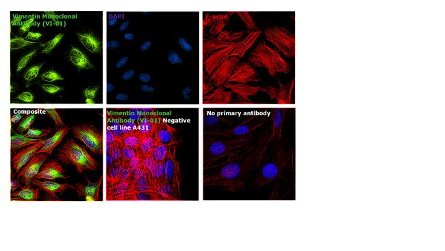 Vimentin Antibody in Immunocytochemistry (ICC/IF)