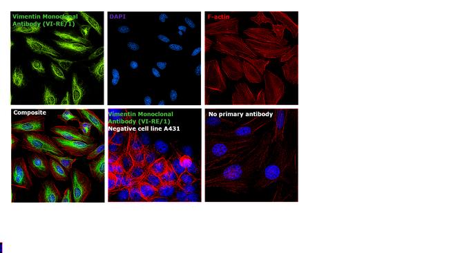 Vimentin Antibody in Immunocytochemistry (ICC/IF)