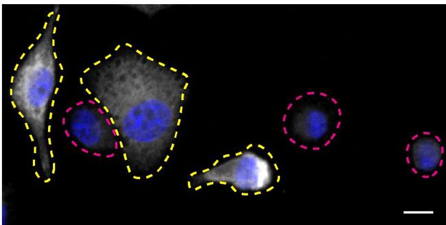 Syk Antibody in Immunocytochemistry (ICC/IF)