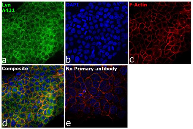 Lyn Antibody in Immunocytochemistry (ICC/IF)