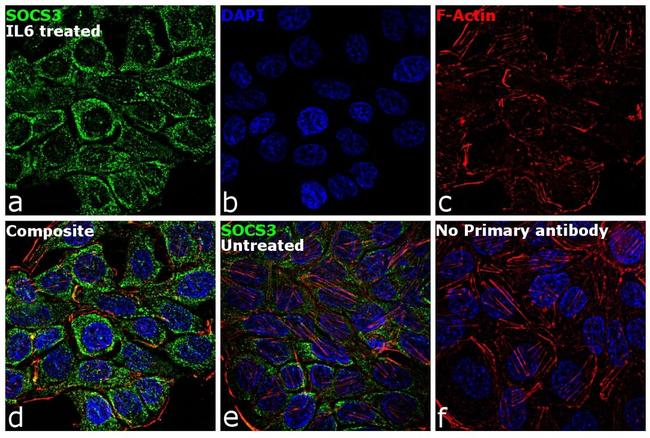 SOCS3 Antibody in Immunocytochemistry (ICC/IF)