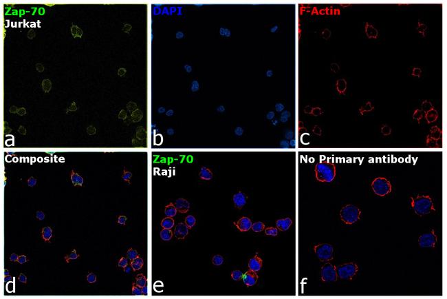 Zap-70 Antibody in Immunocytochemistry (ICC/IF)