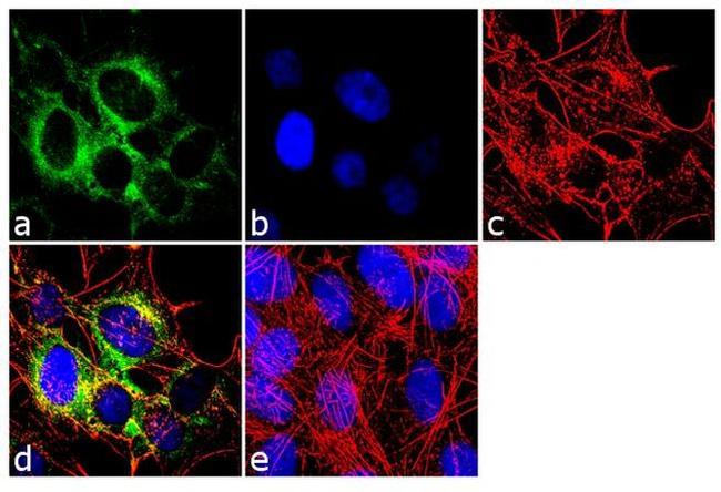 NEFL Antibody in Immunocytochemistry (ICC/IF)