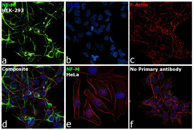 NEFM Antibody in Immunocytochemistry (ICC/IF)