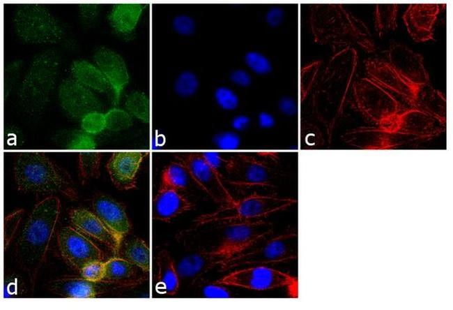 GRK2 Antibody in Immunocytochemistry (ICC/IF)