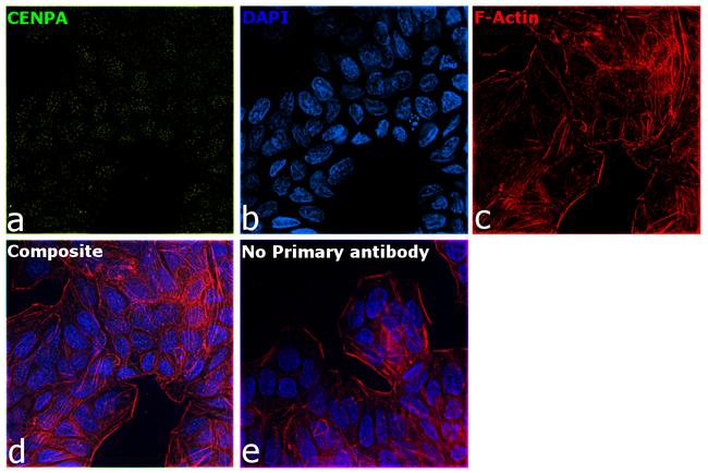 CENPA Antibody in Immunocytochemistry (ICC/IF)