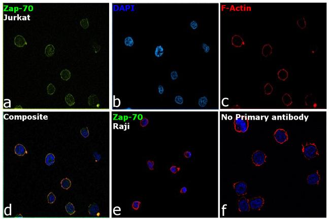 Zap-70 Antibody in Immunocytochemistry (ICC/IF)