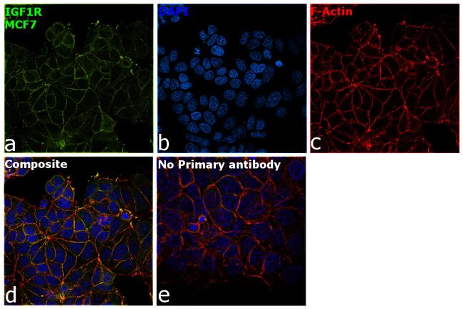 IGF1R alpha Antibody in Immunocytochemistry (ICC/IF)