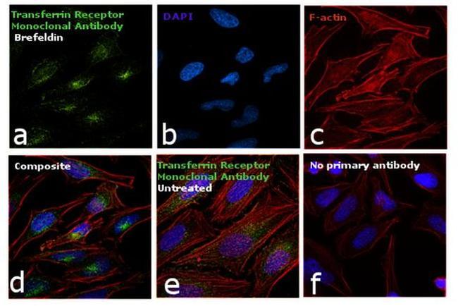 Transferrin Receptor Antibody in Immunocytochemistry (ICC/IF)