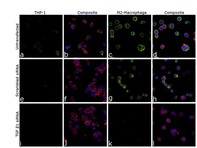 TGF beta-1 Antibody in Immunocytochemistry (ICC/IF)